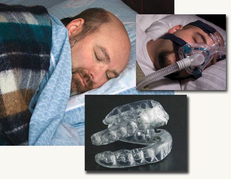 Pros and Cons of Dental Sleep Apnea Treatment Devices
